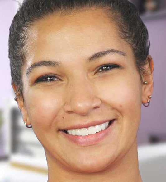 Veneera-Zahn-Veneers-Lea_Nachher_800x880_a6de3953-a13e-442c-800e-52f7d7c7a1a2