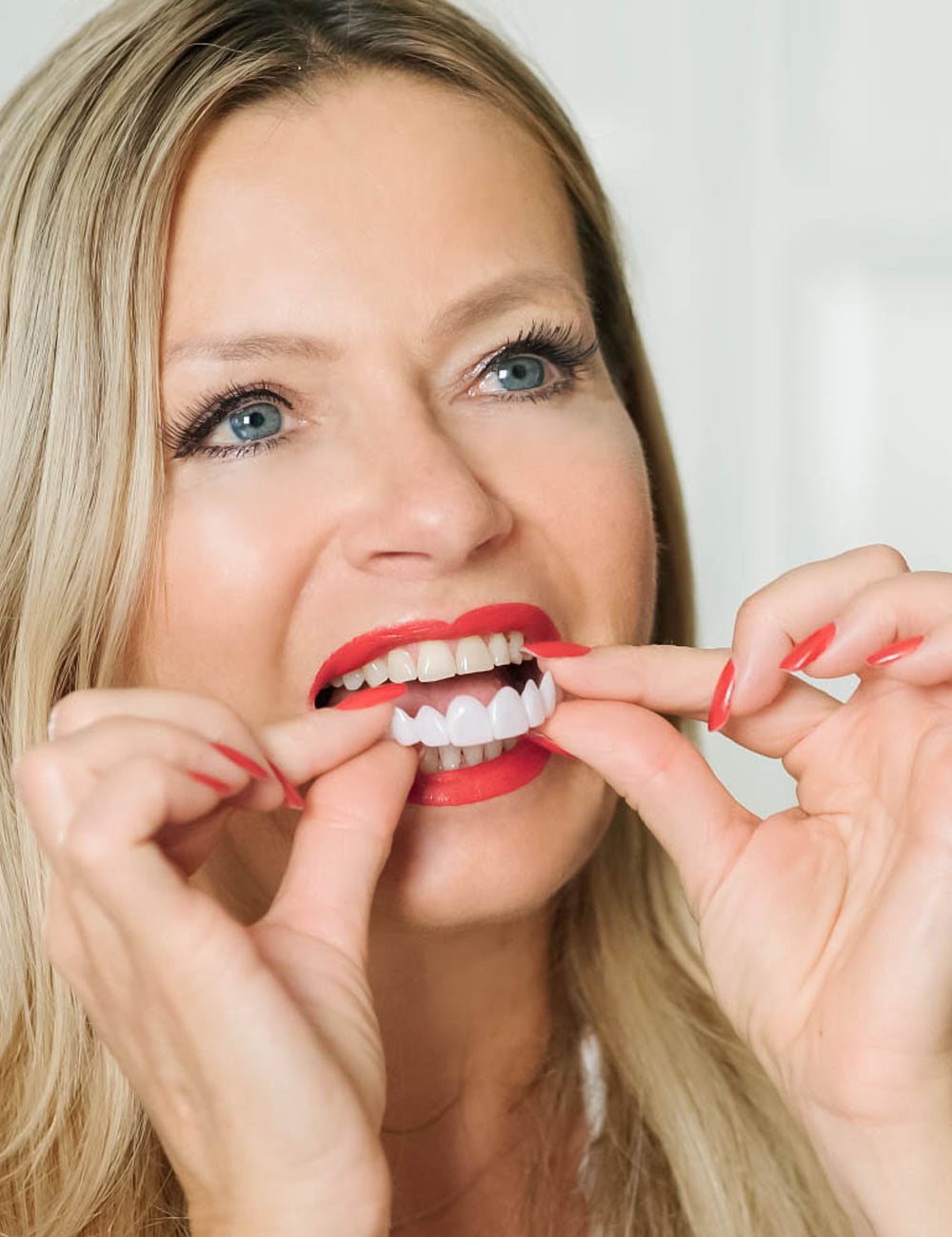 Veneera-Zahn-Veneers-001