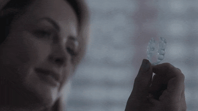 Veneera-Zahn-Veneers-Simone_Gif