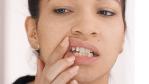 Veneera™ Veneers - Vor_dem_Zahn-Veneer