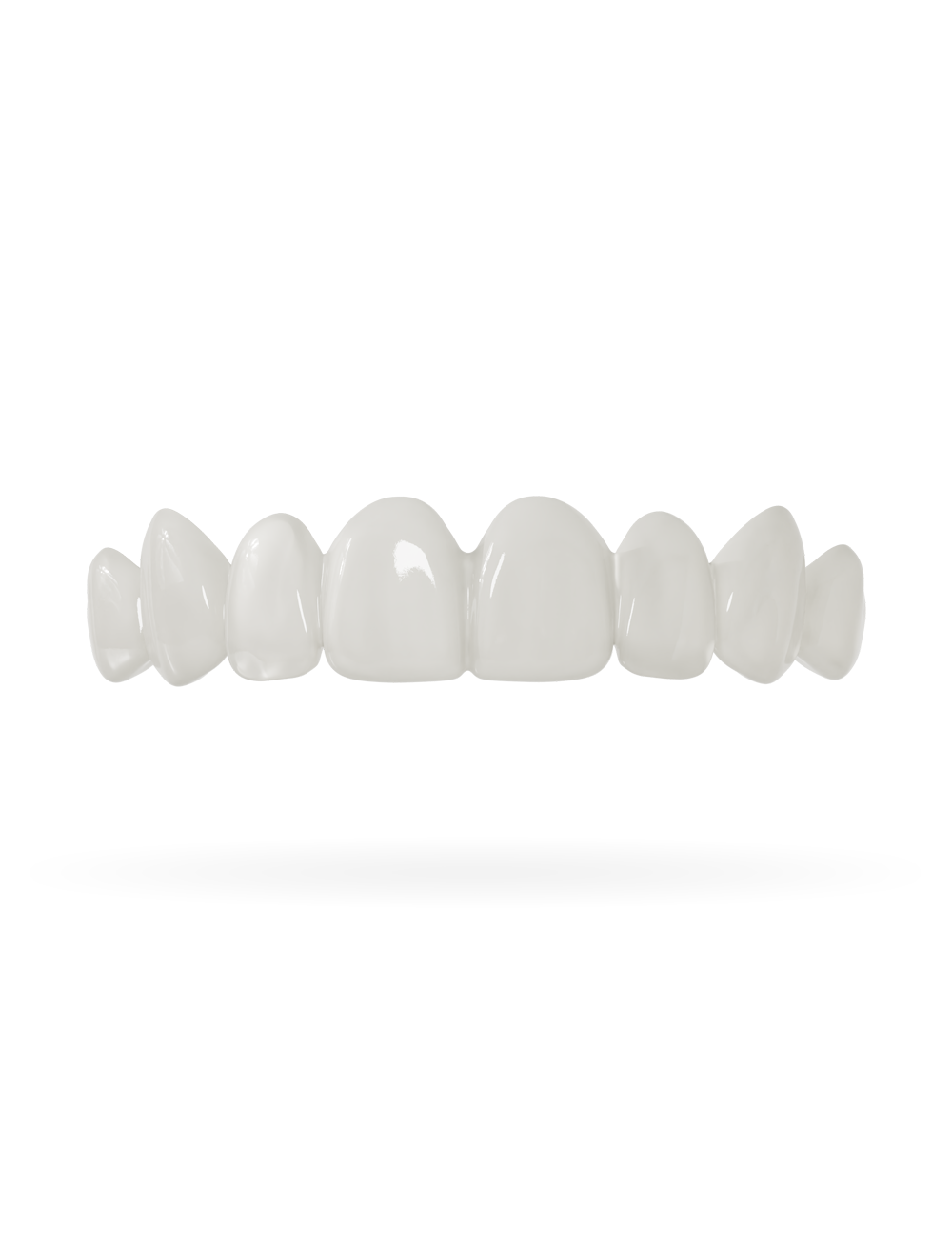 Veneera-Zahn-Veneers-Zahn-VeneerObenNaturweiss